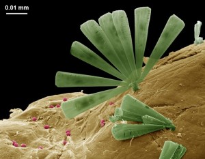 Diatoms (green) and bacteria (pink) living on ocean plastic. This is a false colour SEM image of part of the surface of a 5mm long plastic (yellow) from waters off eastern Tasmania, Australia. Julia Reisser and Jeremy Shaw